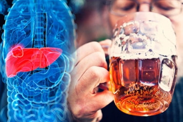 Treatment of Alcoholic Liver Disease in Gurgaon, Best Liver Specialist for Liver Disease in India, Dr Mayank Chugh Best Gastroeneterologist in Gurgaon, Best Gastro Doctor at Asiaz Hospital in Gurgaon