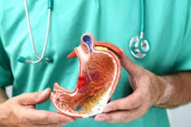 Dr Mayank Chugh, Best Gastro Specialist for Bile Duct Cancer, Best Liver Specialist in Gurgaon Haryana, Best Gastroenterologist in Gurgaon, Treatment of Bile Duct Cancer in Gurgaon, Medical Management for Bile Duct Cancer Treatment, Asiaz Hospital Gurgapn Haryana