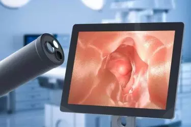 cost of colonoscopy in gurgaon, best doctor for colonoscopy in gurgaon, best gastro specialist doctor in gurgaon, best clinic for colonoscopy test, dr mayank chugh gastro specialist, best centre for colonoscopy test