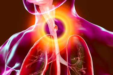 Treatment of Esophageal Cancer in Gurgaon, Dr Mayank Chugh, Best Gastro Specialist in India, Best Doctor for Esophageal Cancer in Gurgaon, Haryana, Liver and Gastro Clinic in Gurgaon